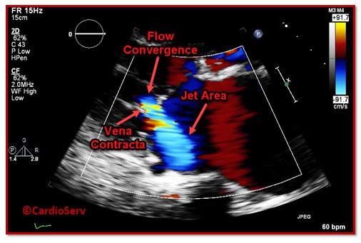 What Do Ultrasound Colours Mean? Understanding Doppler Imaging