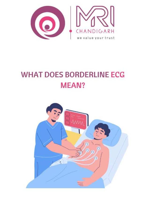 What Does Borderline ECG Mean? Should You Be Concerned?