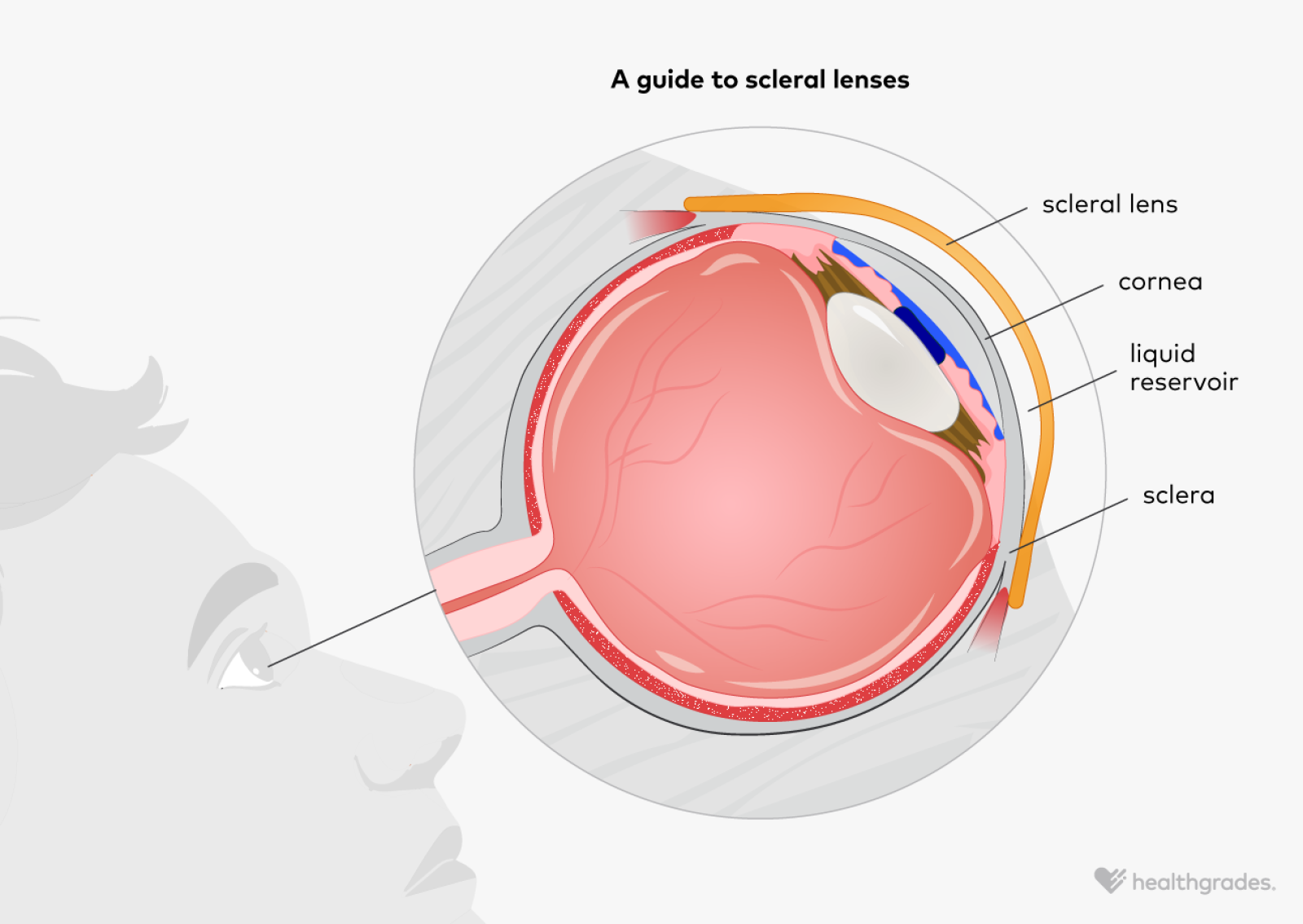 What Do My Scleral Lines Mean? Eye Health Explained